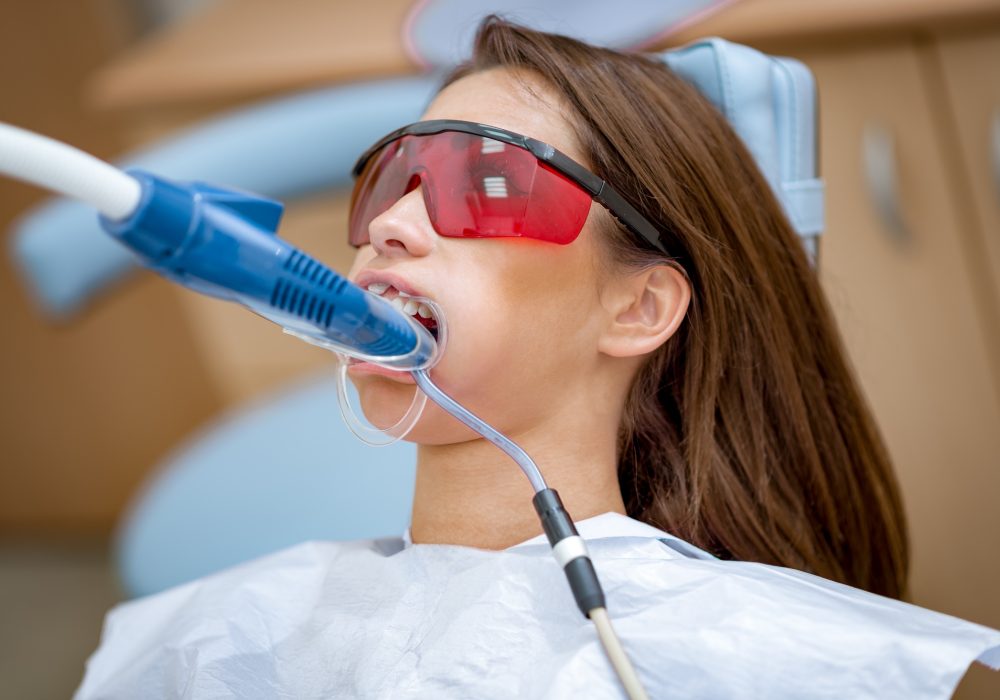 White Teeth For Shiny Smile